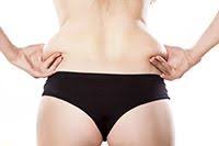 liposuction yag aldirma ile ilgili en cok sorulan sorular defne erkara