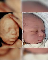 Antes e depois… de um mesmo amor. 💛 A gente sabe que é o mesmo bebê, mas é  impossível não se emocionar ao ver como aquele rostinho que conhecemos  ainda dentro da