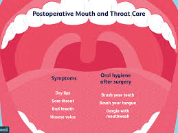 Mouth And Throat Care After Surgery