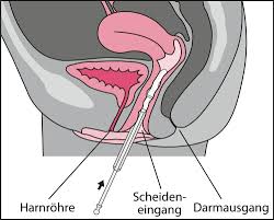 Warum du deinem kind die worte penis, vagina und vulva beibringen solltest! Vagisan Feuchtcreme Bei Scheidentrockenheit