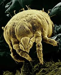 Image result for Dust mite