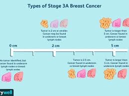 However, as with other types of cancer,. Stage 3 Breast Cancer Types Treatment Survival