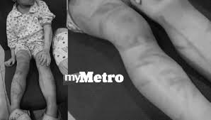 Mereka juga mungkin mengalami trauma yang berpanjangan. Http Eprints Usm My 32055 1 Noor Zulaika Binti Zulkhifli Merican Pdf