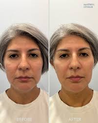 The Aesthetic Clinique