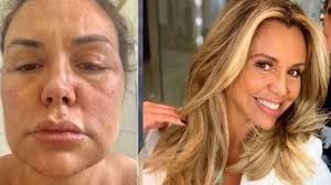 We would like to show you a description here but the site won't allow us. Renata Banhara Sobre Doenca Me Roubaram De Varias Formas