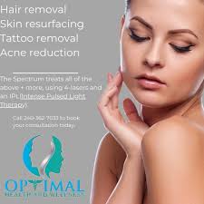 Did you know we offer Laser Treatments? Winter is laser season! The  Spectrum offers laser hair removal, skin resurfacing, acne reduction, and  tattoo removal. Here are some of our favorite reasons to