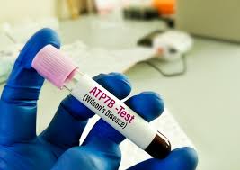 Image result for Wilson Test