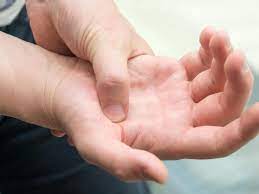 Karpaltunnelsyndrom Haufiges Einschlafen Der Hand Ist Fall Fur Den Arzt