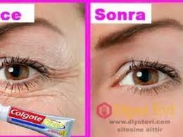 Gozalti Kirisikliklari Icin Dis Macunu Domates Suyu Aloevera Karisimi Wrinkles Tomato Juice Homemade Beauty Care