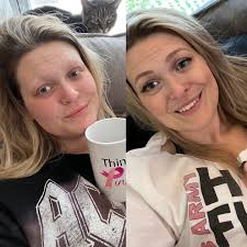 Bailey Kramer (@baileysbreastcancerjourney) • Instagram photos and videos