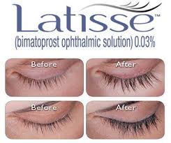 Latisse Still The Best Thing Going Latisse Eyelashes Latisse How To Grow Eyelashes