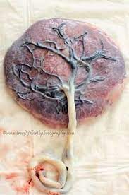Placenta Tree Of Life Birth Art Birth Pictures Home Birth Photography