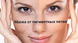 как осветлить пигментные пятна на лице в домашних условиях Pigmentnye Pyatna Odni Iz Samyh Nepriyatnyh Kosmeticheskih Defektov Voznikayushih Po Vine Razlichnyh Faktorov Ot Obshej Zashlakovanno Chistoe Lico Lico Lechenie Pryshej