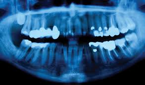 They may look like a patch or a lump or look like an ulcer. Racgp Common Causes Of Swelling In The Oral Cavity