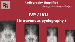 Image result for Intravenous Pyelogram
