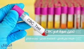تحليل صورة الدم Complete Blood Count Cbc تحليل صورة الدم Cbc