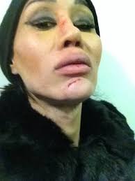 Une histoire vraie et incroyable à la fois. Rafle Au Bois De Boulogne Violences Policieres Racisme Et Transphobie D Etat
