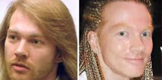 Gone are the days when you could spot. 17 Celebrity Before And After Plastic Surgery Disasters