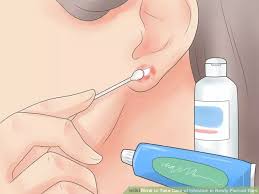 How To Take Care Of Infection In Newly Pierced Ears Infected Ear Piercing Baby Ear Piercing Ear Infection Remedy