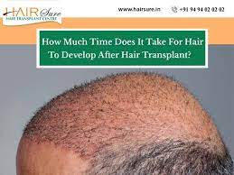 But once the healing process is complete, the transplanted follicles begin to grow hair that will fill out the bald patches on your scalp. How Much Time Does It Take For Hair To Develop After Hair Transplant Hair Sure
