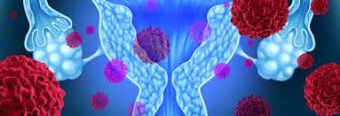 Rahim dipenuhi dengan tisu khas dipanggil sebagai endometrium. Rahim Agzi Kanseri Belirtileri Nelerdir Neolife Tip Merkezi