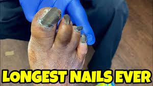 Longest toe nails in the world