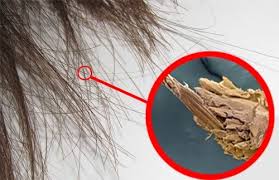 Dein Haar Wird Wachsen Wie Verruckt Und Du Wirst Ein Sehvermogen Wie Ein Adler Haben Iss 3 Essloffel Pro Ta Extrem Trockene Haare Trockene Haare Kaputte Haare