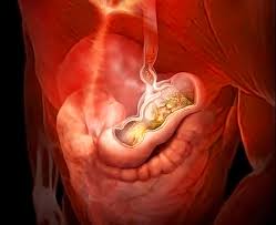 Image result for Succussion Splash