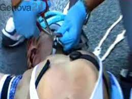 This is really bad that they are showing his body on the internet. Rapallo Giro D Italia Wouter Weylandt Morto Sul Colpo Aperta Inchiesta Genova 24