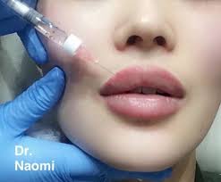 They usually last between 6 and 18 months. Dermal Filler Aftercare What To Do After You Ve Had Dermal Filler Injections