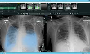 Radiology And Covid 19 How To Establish Safe Workflows