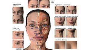 Discover how botulism affects the nervous system and produces skeletal muscle paralysis, its ymptoms and treatment. Botulinium Toxin Injections Le Louarn