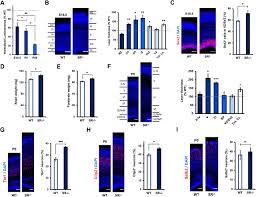 Echa un vistazo a los 10 mejores risk juego de tronos expansion disponibles en las tiendas esta temporada. D Cysteine Is An Endogenous Regulator Of Neural Progenitor Cell Dynamics In The Mammalian Brain Biorxiv