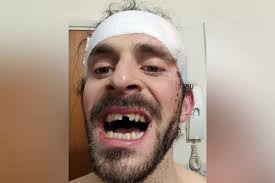 Bath man's terrifying health scare while