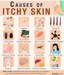 Pin By Sugandha Dutta Bagchi On Skin Remedies In 2021 Itchy Skin Remedy Itchy Skin Itchy Skin Relief