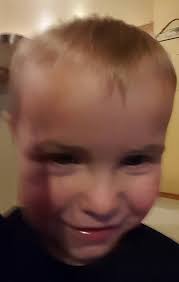 After 223 days Dalton mouthed I love you to his Dad, me and his babies  today. Praise God! What a blessing. Thank you Jesus. This morning I was  singing to him a