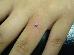 Millennials Why Are Micro Dermal Engagement Rings A Thing Tattoo Wedding Rings Finger Piercing Ring Tattoos