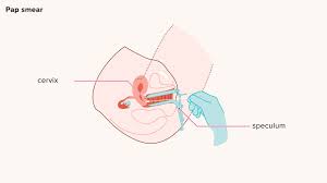 You'll know she's into you if she suggests going out to eat, or (even better) cooking. Cervical Cancer Causes Symptoms Prevention And Treatment