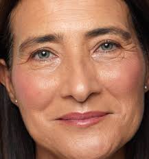 COLORETE EN BÁLSAMO