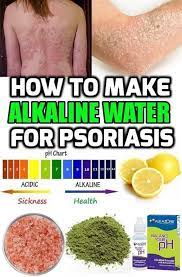 Home Remedies For Psoriasis Home Remedies For Psoriasis Natural Psoriasis Remedies Psoriasis Diet