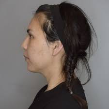 SAGAR PATEL AESTHETICS