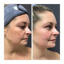 Krista Jacobson (@skinbykrista) • Instagram photos and videos