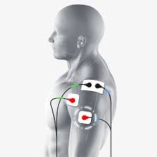 shoulder deltoid electrode pad placement for ems and tens