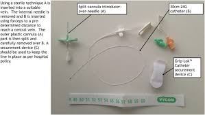 Image result for Difficult Intravenous Access in Children