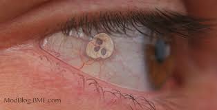 Against fed law to use my religion w.there's no reason to suppress a viewpoint unless it's true,cause a false viewpoint can easily be combated w/facts and logic,while truth cannot be combated except by lies which are vulnerable to refutation. Implants Bme Tattoo Piercing And Body Modification News