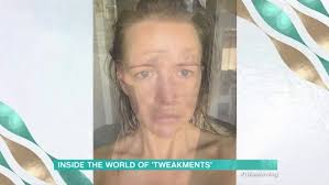 Faye Winter says failed botox result was the 'worst she'd ever felt'