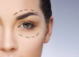 I also have the same problem: Revision Eyelid Surgery Revision Blepharoplasty St Louis Mo