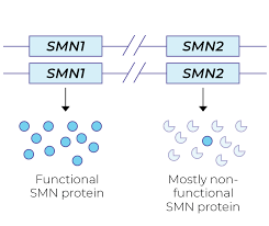 The smn1 gene provides instructions for making the survival motor neuron (smn) protein. Newborn Screening Spinal Muscular Atrophy Sma Mrc Holland