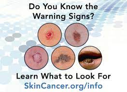 Here we look at some of the key symptoms of this disease to watch out for. ØªÙˆÙŠØªØ± Skincancerfoundation Ø¹Ù„Ù‰ ØªÙˆÙŠØªØ± Early Detection Is Critical In Treating Skincancer Learn How To Identify Its Warning Signs Http T Co Zlj60mvxsd Http T Co Jim5rwhacx