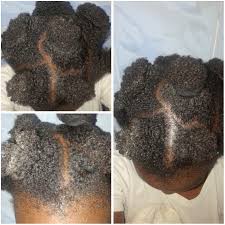 Hair food apple cider vinegar hair rinse helps cleanse your hair of product buildup, leaving it clean and rejuvenated. Apple Cider Vinegar On Natural Hair Bookie Kunlere